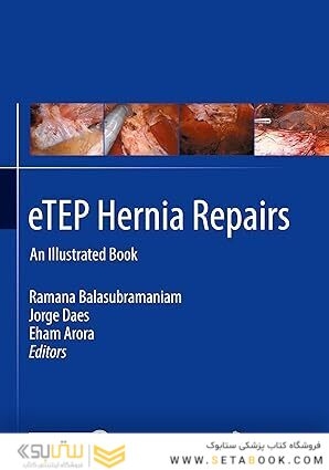 eTEP Hernia Repairs: An Illustrated Book