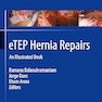 eTEP Hernia Repairs: An Illustrated Book