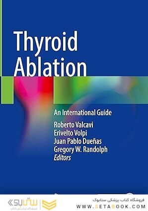 Thyroid Ablation: An International Guide With Online Files