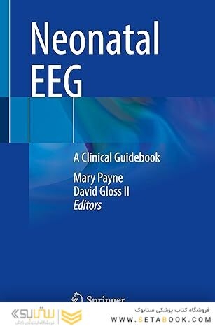 Neonatal EEG: A Clinical Guidebook