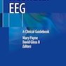 Neonatal EEG: A Clinical Guidebook