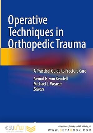 Operative Techniques in Orthopedic Trauma: A Practical Guide to Fracture Care