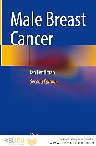 Male Breast Cancer