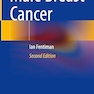 Male Breast Cancer