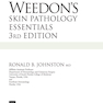 Weedon