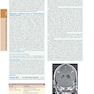 The Principles of Harrison’s Internal Medicine: Neurological Diseases 2026