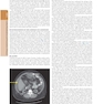The Principles of Harrison’s Internal Medicine: Liver and Pancreatic Diseases 2026