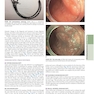 The Principles of Harrison’s Internal Medicine: Gastrointestinal Diseases 2026