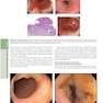 The Principles of Harrison’s Internal Medicine: Gastrointestinal Diseases 2026