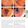 The Principles of Harrison’s Internal Medicine: Gastrointestinal Diseases 2026