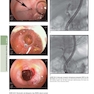 The Principles of Harrison’s Internal Medicine: Gastrointestinal Diseases 2026