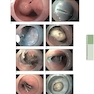 The Principles of Harrison’s Internal Medicine: Gastrointestinal Diseases 2026