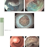The Principles of Harrison’s Internal Medicine: Gastrointestinal Diseases 2026