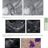 The Principles of Harrison’s Internal Medicine: Gastrointestinal Diseases 2026