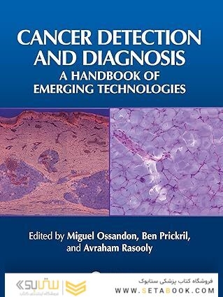 Cancer Detection and Diagnosis: A Handbook of Emerging Technologies 1st Edition
