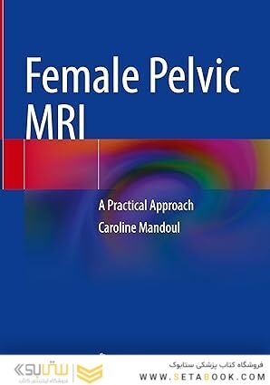 Female Pelvic MRI: A Practical Approach