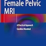 Female Pelvic MRI: A Practical Approach