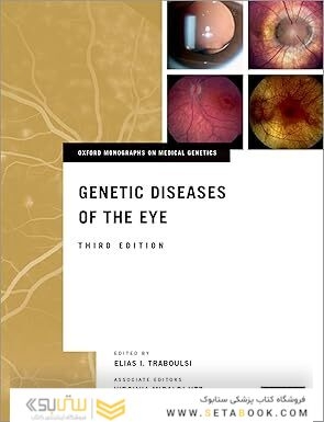 Genetic Diseases of the Eye