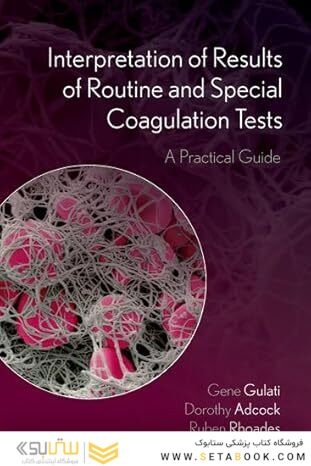 Interpretation of Results of Routine and Special Coagulation Tests: A Practical Guide