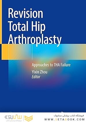 Revision Total Hip Arthroplasty: Approaches to THA Failure