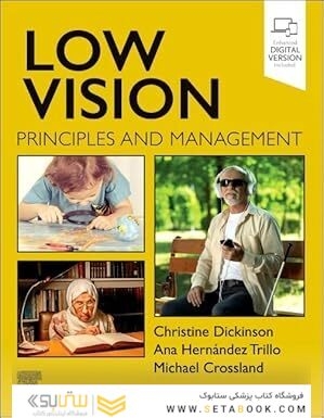 Low Vision: Principles and Management 1st Edition
