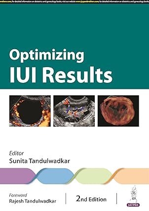 عکس OPTIMIZING IUI RESULTS