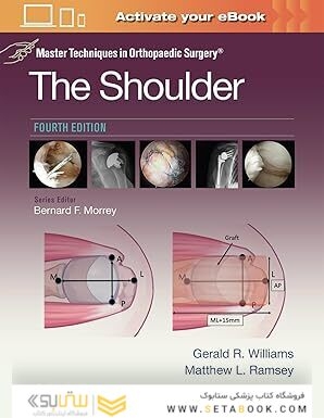 Master Techniques in Orthopaedic Surgery