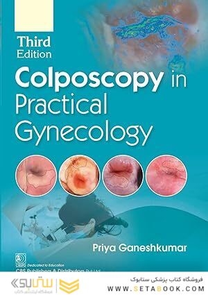 Colposcopy In Practical Gynecology