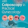 Colposcopy In Practical Gynecology