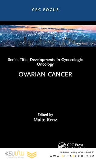 Ovarian Cancer