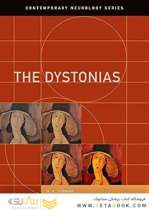 The Dystonias