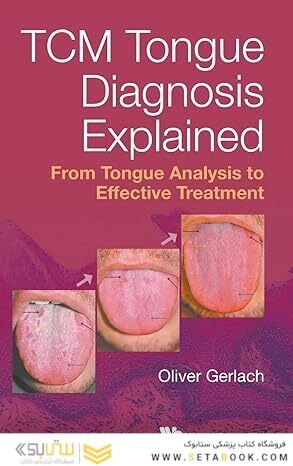 Tcm Tongue Diagnosis Explained
