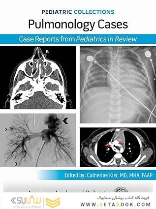 Pediatric Collections: Pulmonology Cases