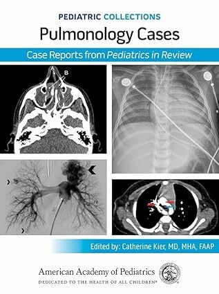 عکس Pediatric Collections: Pulmonology Cases