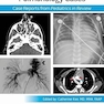Pediatric Collections: Pulmonology Cases