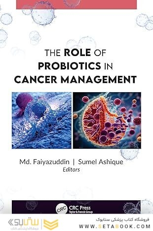 The Role of Probiotics in Cancer Management