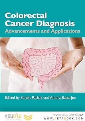 Colorectal Cancer Diagnosis: Advancements and Applications 1st Edition