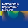 Controversies in Hepatocellular Carcinoma