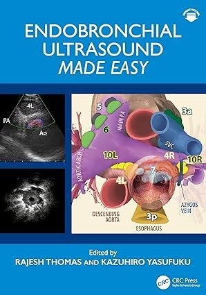 عکس Endobronchial Ultrasound Made Easy: Made Easy 1st Edition