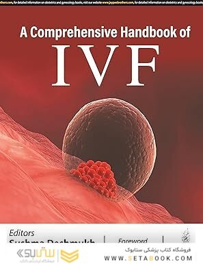 A COMPREHENSIVE HANDBOOK OF IVF