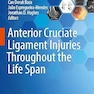 Anterior Cruciate Ligament Injuries Throughout the Life Span