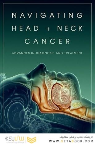Navigating Head and Neck Cancer
