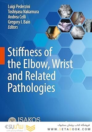 Stiffness of the Elbow, Wrist and Related Pathologies