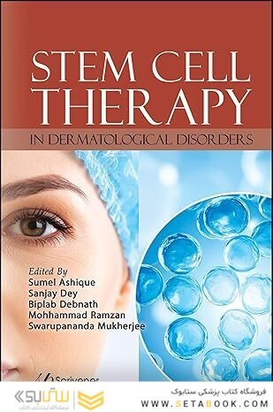 Stem Cell Therapy in Dermatological Disorders