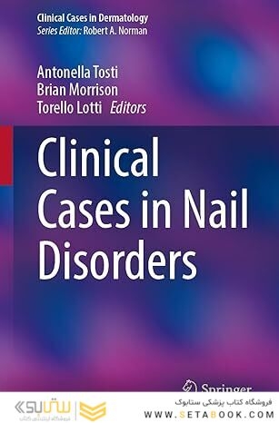 Clinical Cases in Nail Disorders
