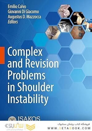 Complex and Revision Problems in Shoulder Instability