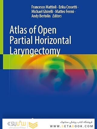 Atlas of Open Partial Horizontal Laryngectomy