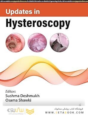 UPDATES IN HYSTEROSCOPY