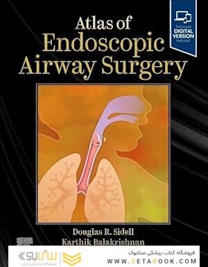 Atlas of Endoscopic Airway Surgery 1st Edition