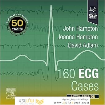 160 ECG Cases 6th Edition